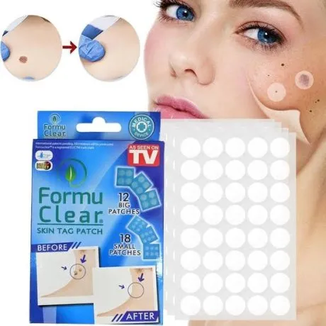 Forum Clear لإزالة التالول و الزوائد الجلدية 